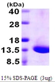 Human DYNLT1 protein, His tag. GTX67881-pro