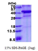 Human XRCC3 protein, His tag. GTX67942-pro