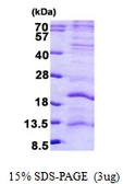 Human LAGE3 protein, His tag. GTX67970-pro