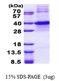 Human KLF7 protein, His tag. GTX67985-pro