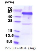 Human EIF3F protein, His tag. GTX67991-pro