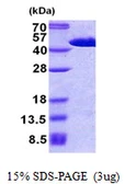 Human FIBP protein, His tag. GTX68031-pro