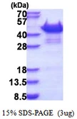 Human Vinexin protein, His tag. GTX68124-pro