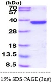 Human Annexin A10 protein, His tag. GTX68234-pro