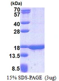 Human TUSC2 protein, His tag. GTX68248-pro