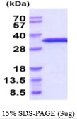 Mouse eIF4E protein, His tag. GTX68260-pro