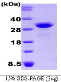 Human OSTF1 protein, His tag. GTX68385-pro