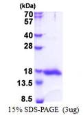 Human Galectin 13 protein, His tag. GTX68440-pro