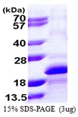 Human fast skeletal Myosin protein, His tag. GTX68445-pro