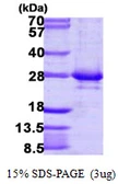 Human RAB14 protein, His tag. GTX68519-pro