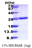 Human RAB6B protein, His tag. GTX68520-pro