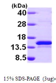 Human Selenoprotein R protein, His tag. GTX68537-pro