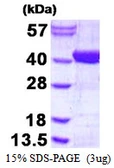 Human ADPRHL2 protein, His tag. GTX68567-pro