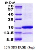 Human PNRC2 protein, His tag. GTX68600-pro