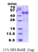 Human MEIS3 protein, His tag. GTX68639-pro