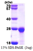 Human PCNP protein, His tag. GTX68649-pro