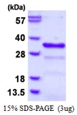 Human CHMP1B protein, His tag. GTX68651-pro