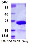 Human MYL7 protein, His tag. GTX68673-pro