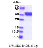 Human MESDC1 protein, His tag. GTX68678-pro