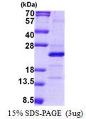 Human MRPS25 protein, His tag. GTX68698-pro