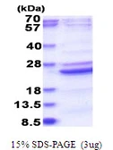 Human B9D2 protein, His tag. GTX68763-pro