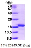 Human AIF1L protein, His tag. GTX68780-pro