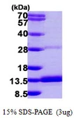 Human DYNLRB2 protein, His tag. GTX68784-pro