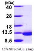 Human DYNLRB1 protein, His tag. GTX68785-pro
