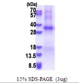 Human TSSK6 protein, His tag. GTX68793-pro