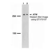 Anti-ATM antibody [5C2] used in Western Blot (WB). GTX70107