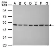 Anti-PSMC5 antibody [25D5] used in Western Blot (WB). GTX70288