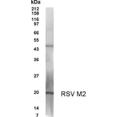 Anti-Respiratory Syncytial virus M2 antibody used in Western Blot (WB). GTX70383