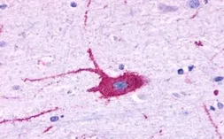 Anti-P2Y5 antibody used in IHC (Paraffin sections) (IHC-P). GTX71897