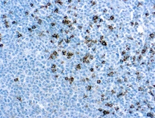Anti-CD8 antibody [144B] used in IHC (Paraffin sections) (IHC-P). GTX72053
