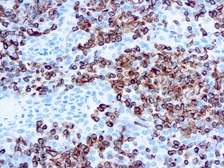 Anti-Vimentin antibody [V9] (ready-to-use) used in IHC (Paraffin sections) (IHC-P). GTX73540