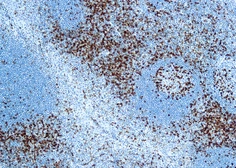Anti-CD45RO antibody [UCHL1] used in IHC (Paraffin sections) (IHC-P). GTX73564
