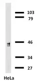 Anti-Cytokeratin 18 antibody [C-04] (Biotin) used in Western Blot (WB). GTX78237