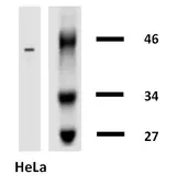 Anti-Cytokeratin 18 antibody [DA-7] (Biotin) used in Western Blot (WB). GTX78240