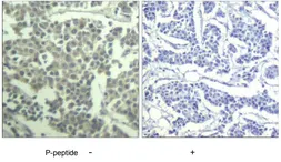 Anti-c-kit (phospho Tyr936) antibody used in IHC (Paraffin sections) (IHC-P). GTX79104