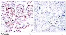 Anti-ATF2 (phospho Ser112) antibody used in IHC (Paraffin sections) (IHC-P). GTX79131