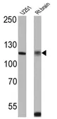 Anti-Calcium Sensing Receptor antibody used in Western Blot (WB). GTX79178