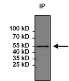 Anti-PAX6 antibody used in Immunoprecipitation (IP). GTX79189