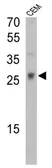 Anti-TCR V gamma 9 antibody [7A5] used in Western Blot (WB). GTX79233