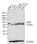 Anti-GDI1 antibody used in Western Blot (WB). GTX79368