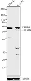 Anti-PTH1R antibody used in Western Blot (WB). GTX79394