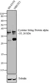 Anti-Cysteine String Protein alpha antibody used in Western Blot (WB). GTX79403