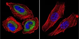 Anti-CNG Channel antibody [CNC 9C1] used in Immunocytochemistry/ Immunofluorescence (ICC/IF). GTX79456