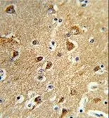 Anti-PPM1H antibody, Internal used in IHC (Paraffin sections) (IHC-P). GTX80567