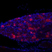 Anti-VR1/ TRPV1 antibody used in Immunohistochemistry (IHC). GTX80798