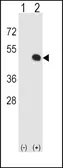 Anti-HLA-E antibody, Internal used in Western Blot (WB). GTX81202